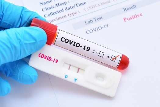 76 noi cazuri de coronavirus la Arad, în ultimele 24 de ore