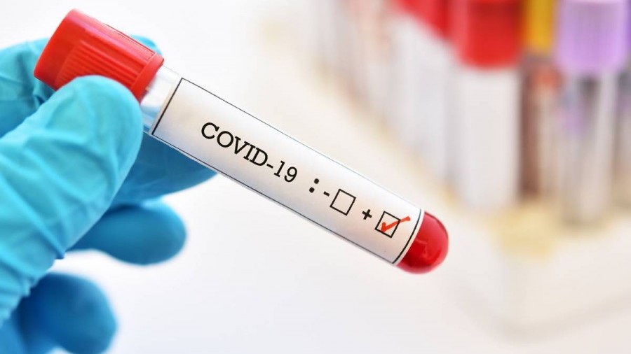 Testarea rapidă în farmacii pentru depistarea COVID-19, aprobată de Ministerul Sănătăţii; ordinul - în Monitorul Oficial
