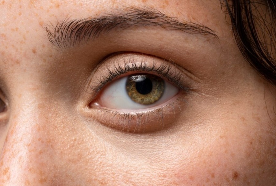 Ulciorul la ochi: Cauze, Simptome și Tratament