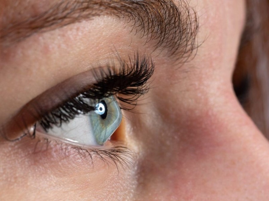 Keratoconul: o afectiune oftalmologica care poate afecta vederea